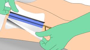 Kare Patch thumbnail 1